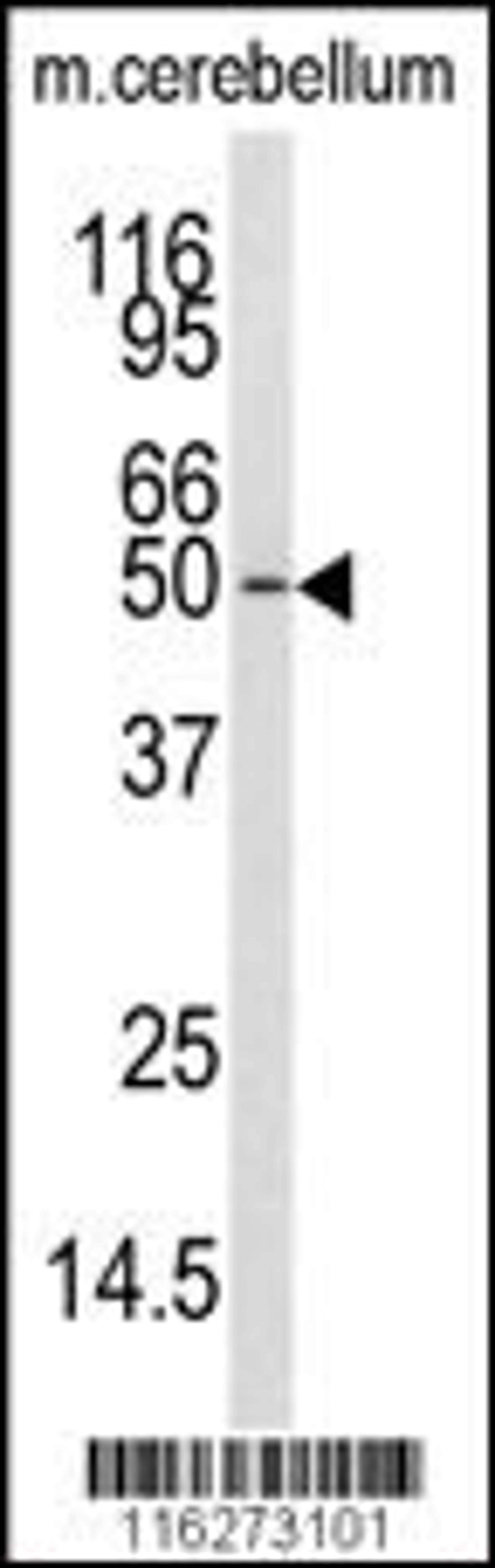 Western blot analysis of anti-CAMKK1 Antibody in mouse cerebellum tissue lysates (35ug/lane)