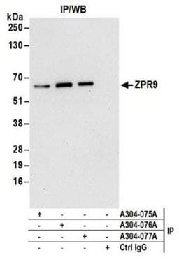 Detection of human ZPR9 by western blot of immunoprecipitates.