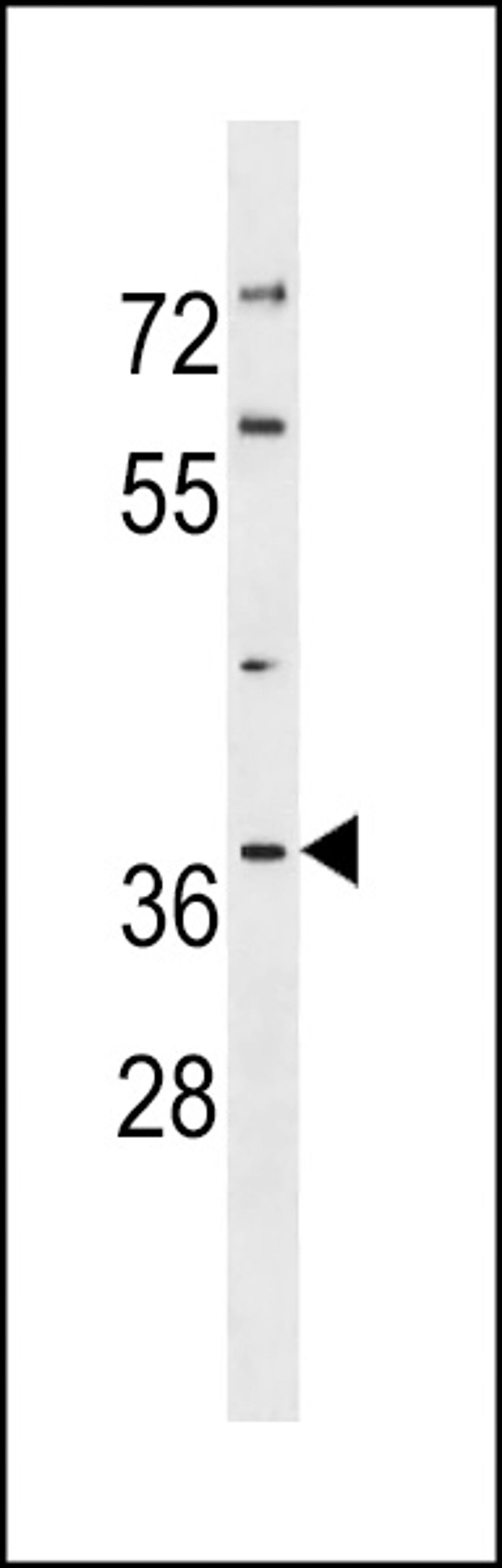 Western blot analysis in NCI-H460 cell line lysates (35ug/lane).