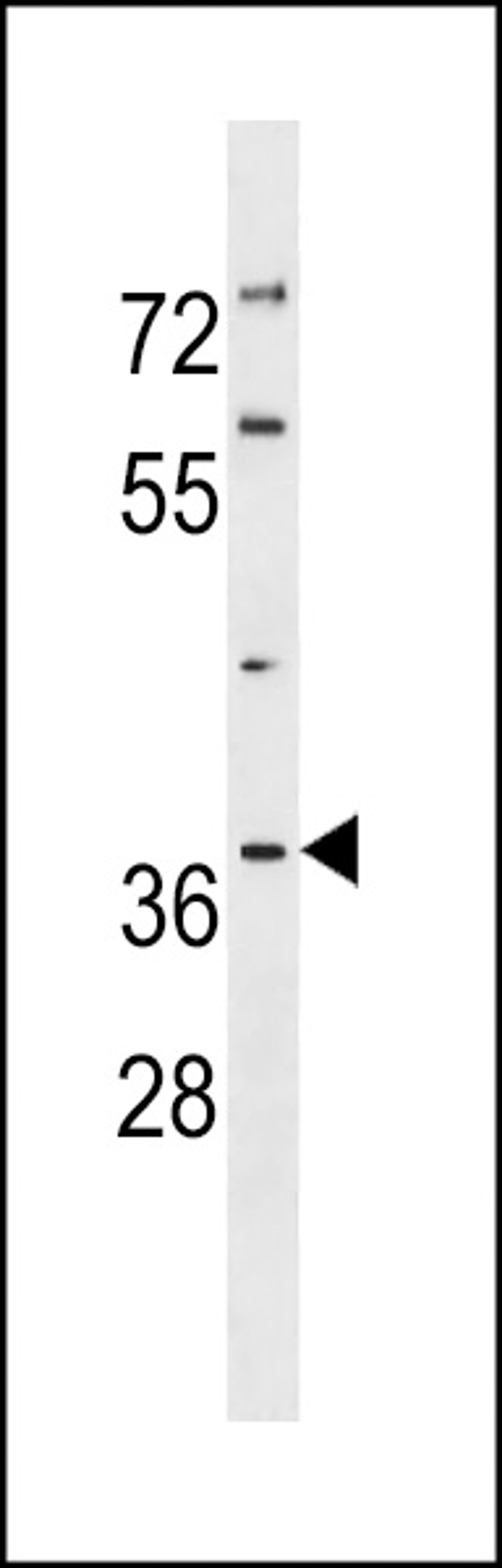 Western blot analysis in NCI-H460 cell line lysates (35ug/lane).