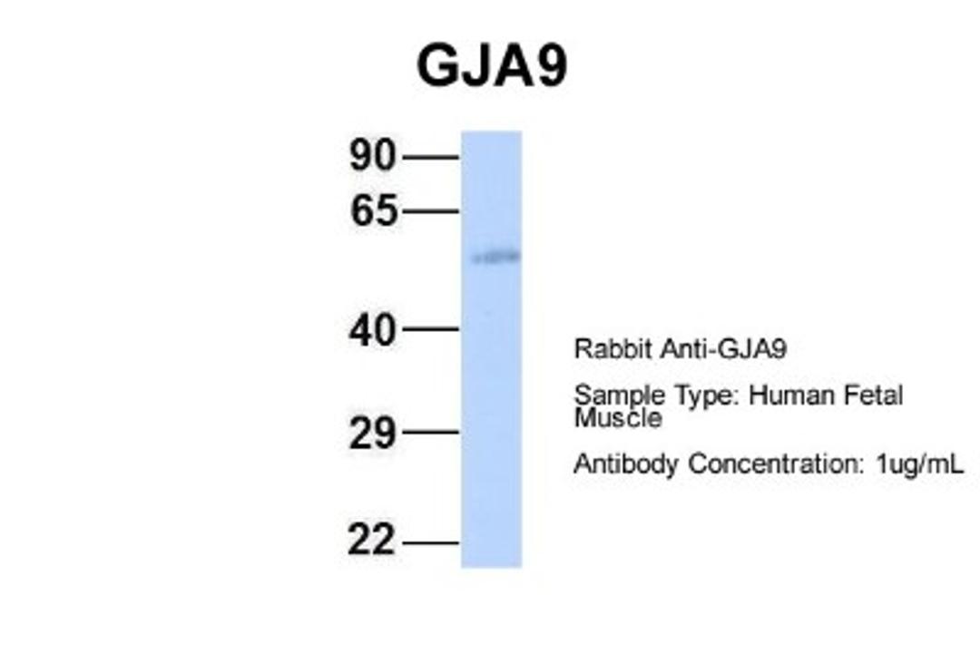 Western Blot: Connexin 58/GJA9 Antibody [NBP1-59196] - Human Fetal Muscle, Antibody Dilution: 1.0 ug/ml.