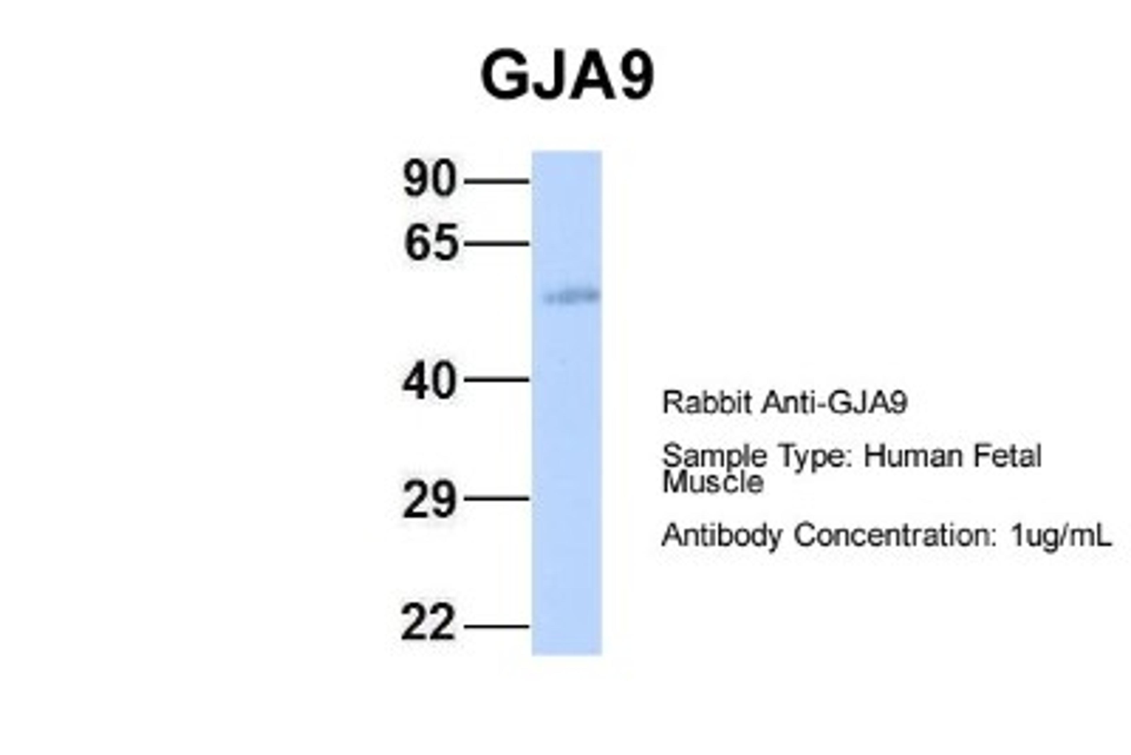 Western Blot: Connexin 58/GJA9 Antibody [NBP1-59196] - Human Fetal Muscle, Antibody Dilution: 1.0 ug/ml.