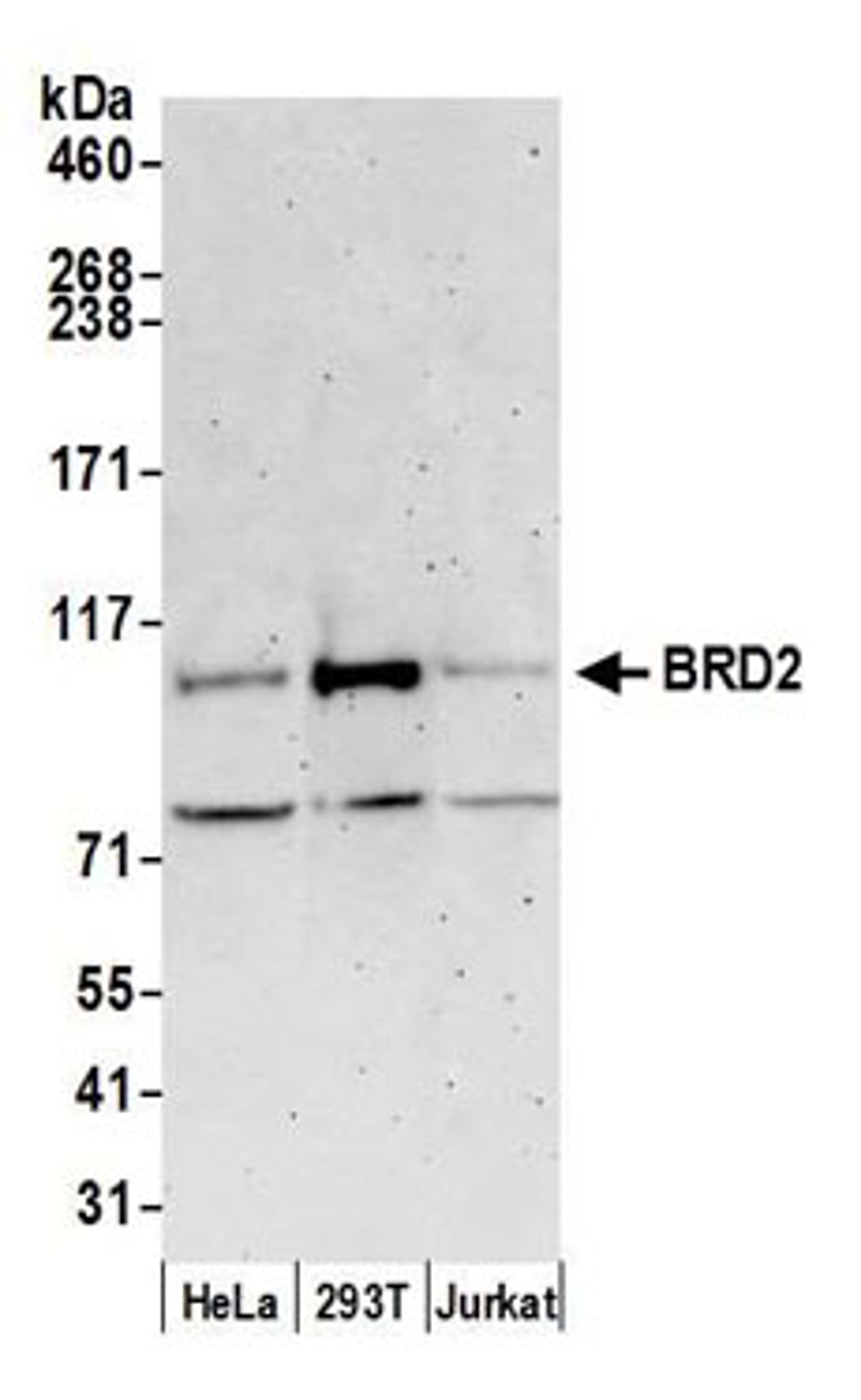 Detection of human BRD2 by western blot.