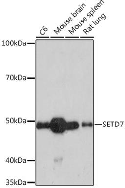 Western blot - SETD7 Rabbit mAb (A9225)