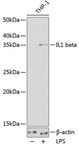 Western blot - IL1 beta antibody (A19635)