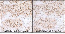 Detection of human RPA70 by immunohistochemistry.