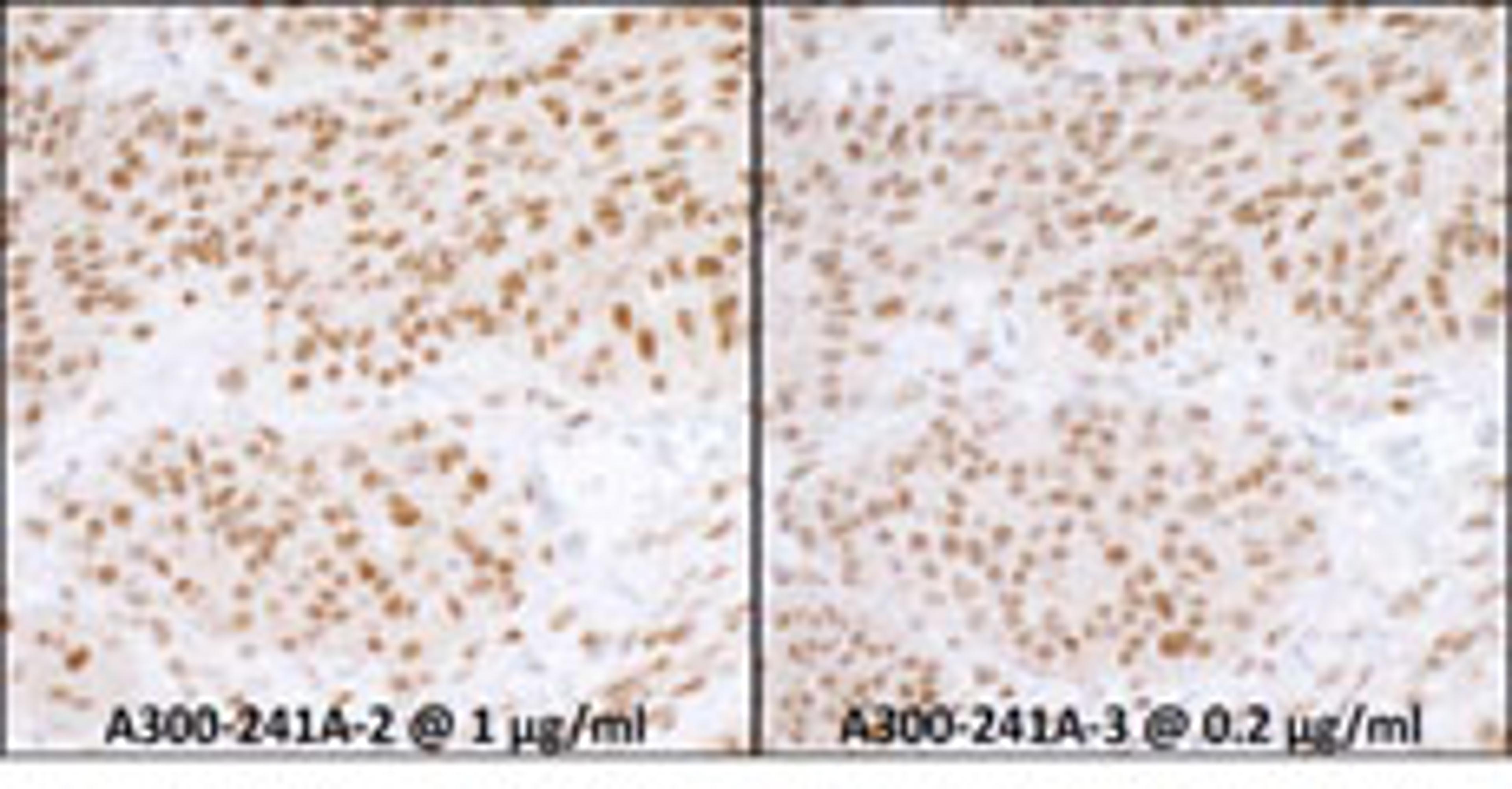 Detection of human RPA70 by immunohistochemistry.