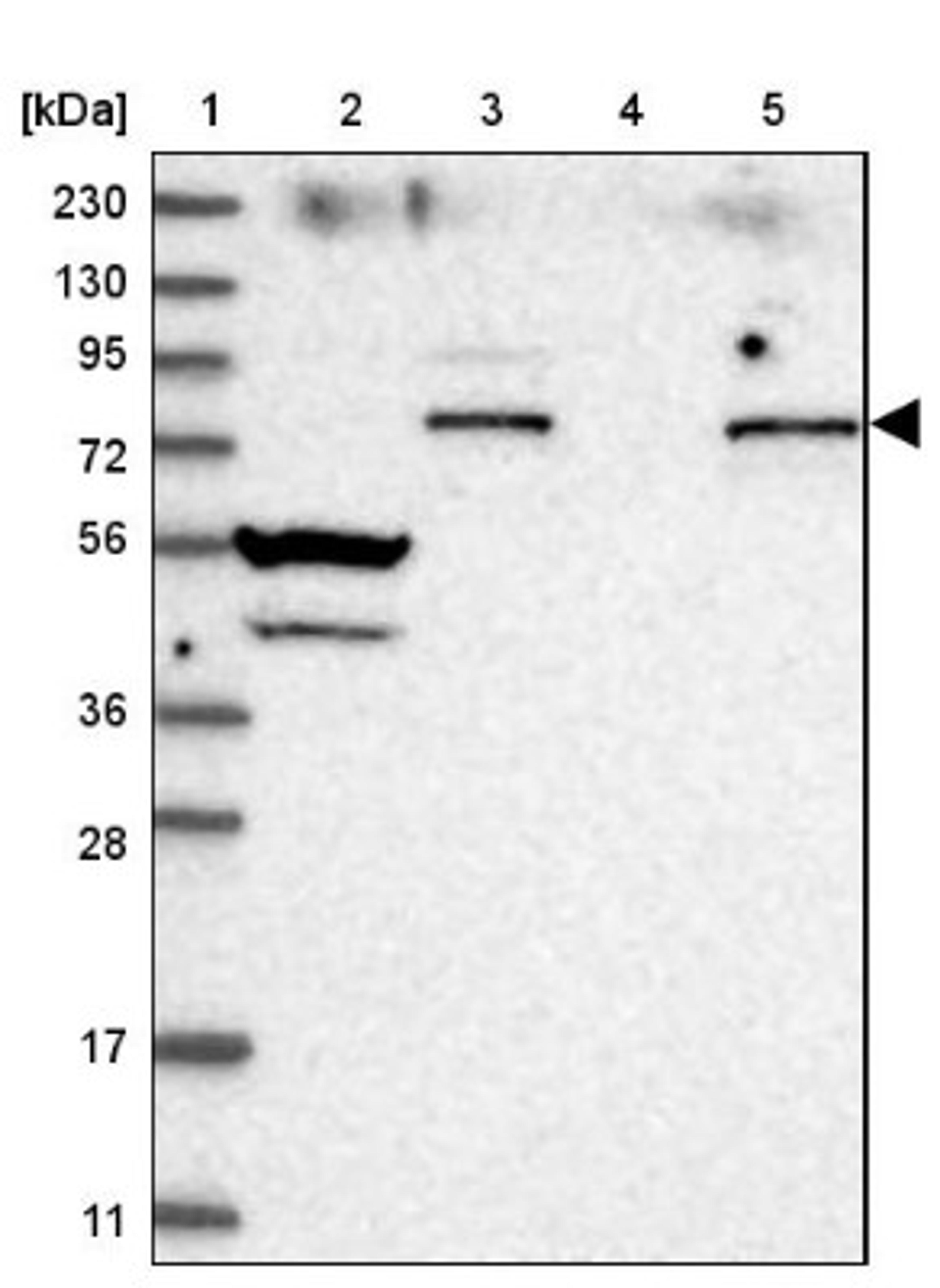 Western Blot: MEKK3 Antibody [NBP2-34004] - Lane 1: Marker [kDa] 230, 130, 95, 72, 56, 36, 28, 17, 11<br/>Lane 2: Human cell line RT-4<br/>Lane 3: Human cell line U-251MG sp<br/>Lane 4: Human plasma (IgG/HSA depleted)<br/>Lane 5: Human liver tissue