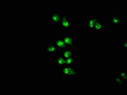 Immunofluorescence staining of Hela cells with CSB-PA859113EA01HU at 1:166, counter-stained with DAPI. The cells were fixed in 4% formaldehyde, permeabilized using 0.2% Triton X-100 and blocked in 10% normal Goat Serum. The cells were then incubated with the antibody overnight at 4&deg;C. The secondary antibody was Alexa Fluor 488-congugated AffiniPure Goat Anti-Rabbit IgG(H+L).