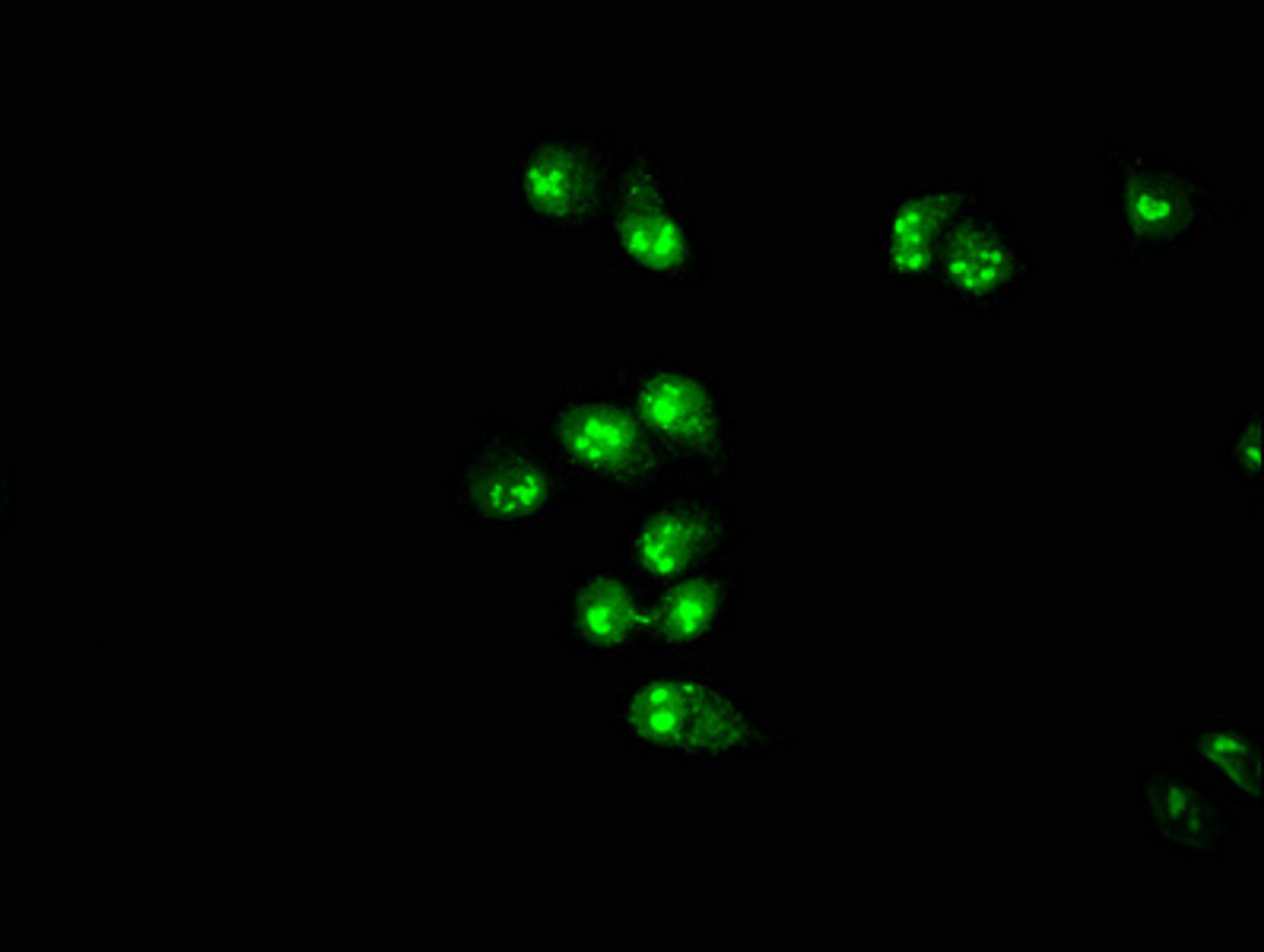 Immunofluorescence staining of Hela cells with CSB-PA859113EA01HU at 1:166, counter-stained with DAPI. The cells were fixed in 4% formaldehyde, permeabilized using 0.2% Triton X-100 and blocked in 10% normal Goat Serum. The cells were then incubated with the antibody overnight at 4&deg;C. The secondary antibody was Alexa Fluor 488-congugated AffiniPure Goat Anti-Rabbit IgG(H+L).