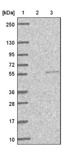 Western Blot: Sorting Nexin 32 Antibody [NBP1-92424] - Lane 1: Marker [kDa] 250, 130, 95, 72, 55, 36, 28, 17, 10<br/>Lane 2: Negative control (vector only transfected HEK293T lysate)<br/>Lane 3: Over-expression lysate (Co-expressed with a C-terminal myc-DDK tag (~3.1 kDa) in mammalian HEK293T cells, LY407310)