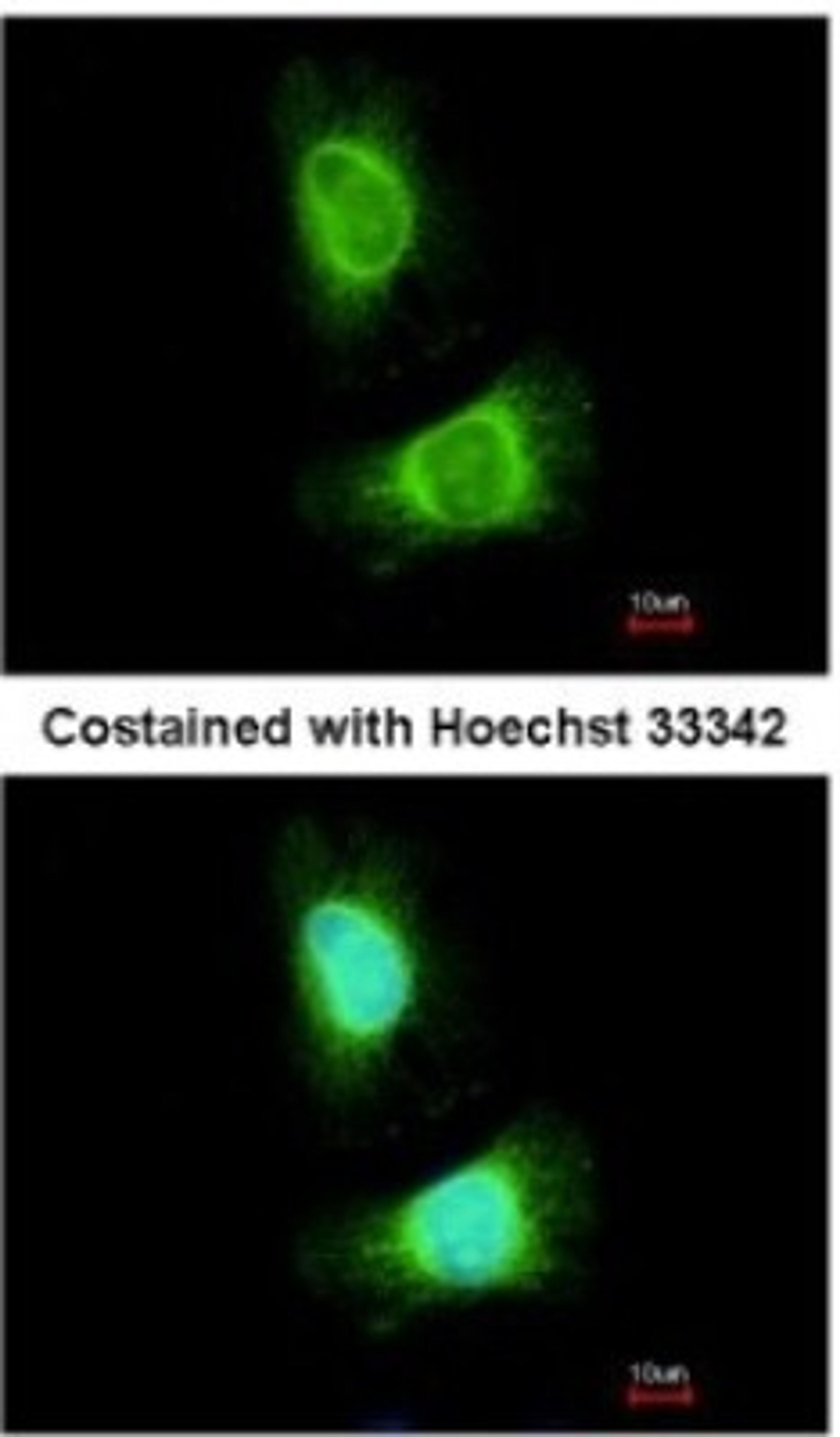 Immunocytochemistry/Immunofluorescence: ACADVL Antibody [NBP2-15238] - Analysis of methanol-fixed HeLa, using antibody at 1:200 dilution.