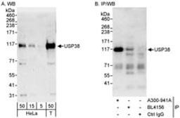 Detection of human USP38 by western blot and immunoprecipitation.