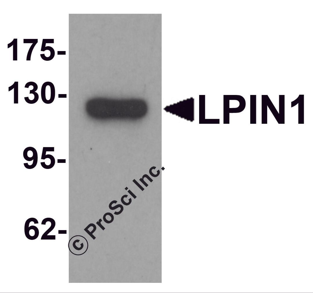 Western blot analysis of LPIN1 in K562 cell lysate with LPIN1 antibody at 1 μg/mL.