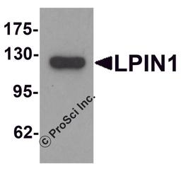 Western blot analysis of LPIN1 in K562 cell lysate with LPIN1 antibody at 1 μg/mL.