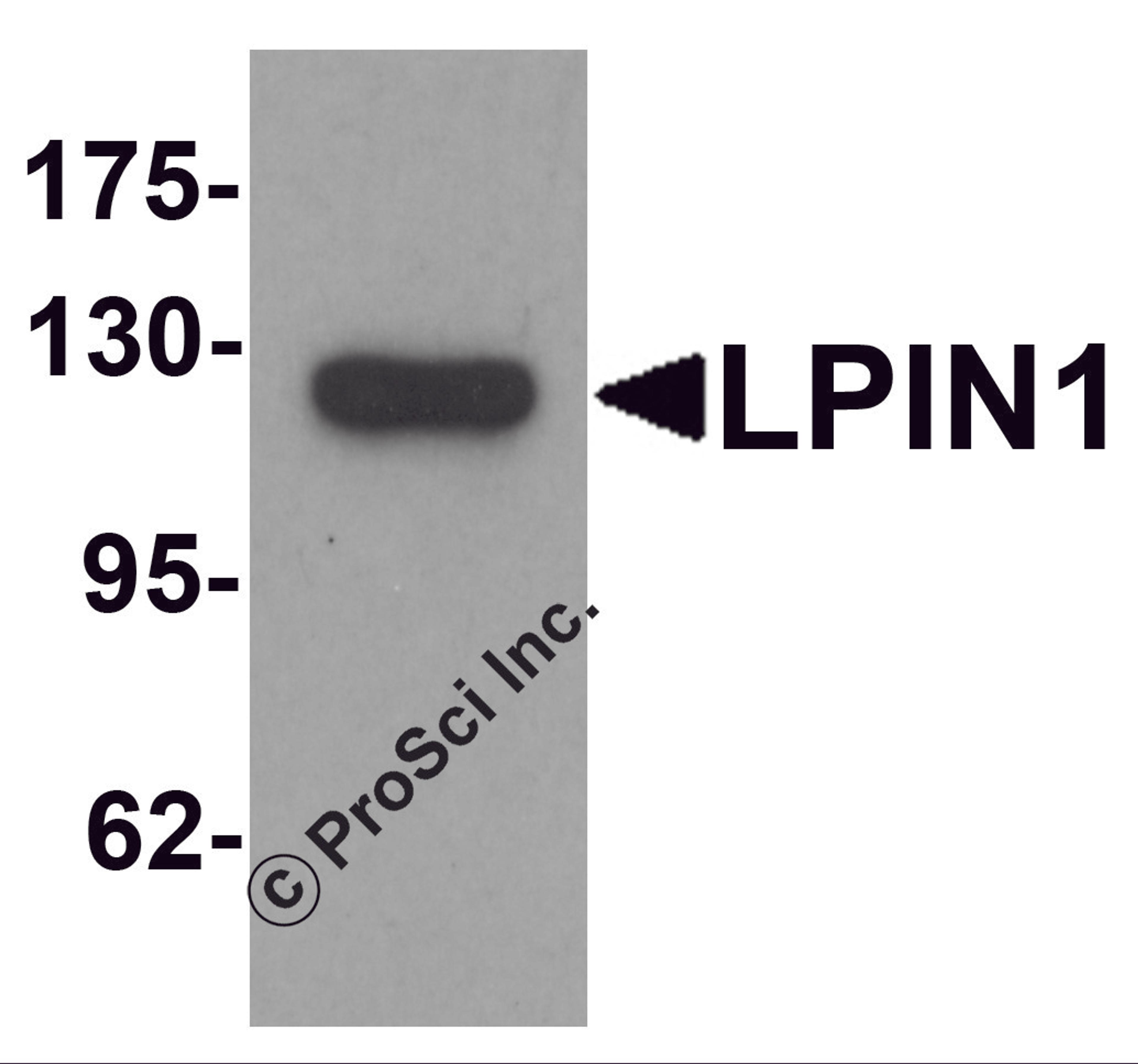 Western blot analysis of LPIN1 in K562 cell lysate with LPIN1 antibody at 1 μg/mL.