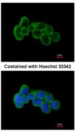 Immunocytochemistry/Immunofluorescence: FLRT1 Antibody [NBP1-31403] - Analysis of methanol-fixed A431, using antibody at 1:200 dilution.