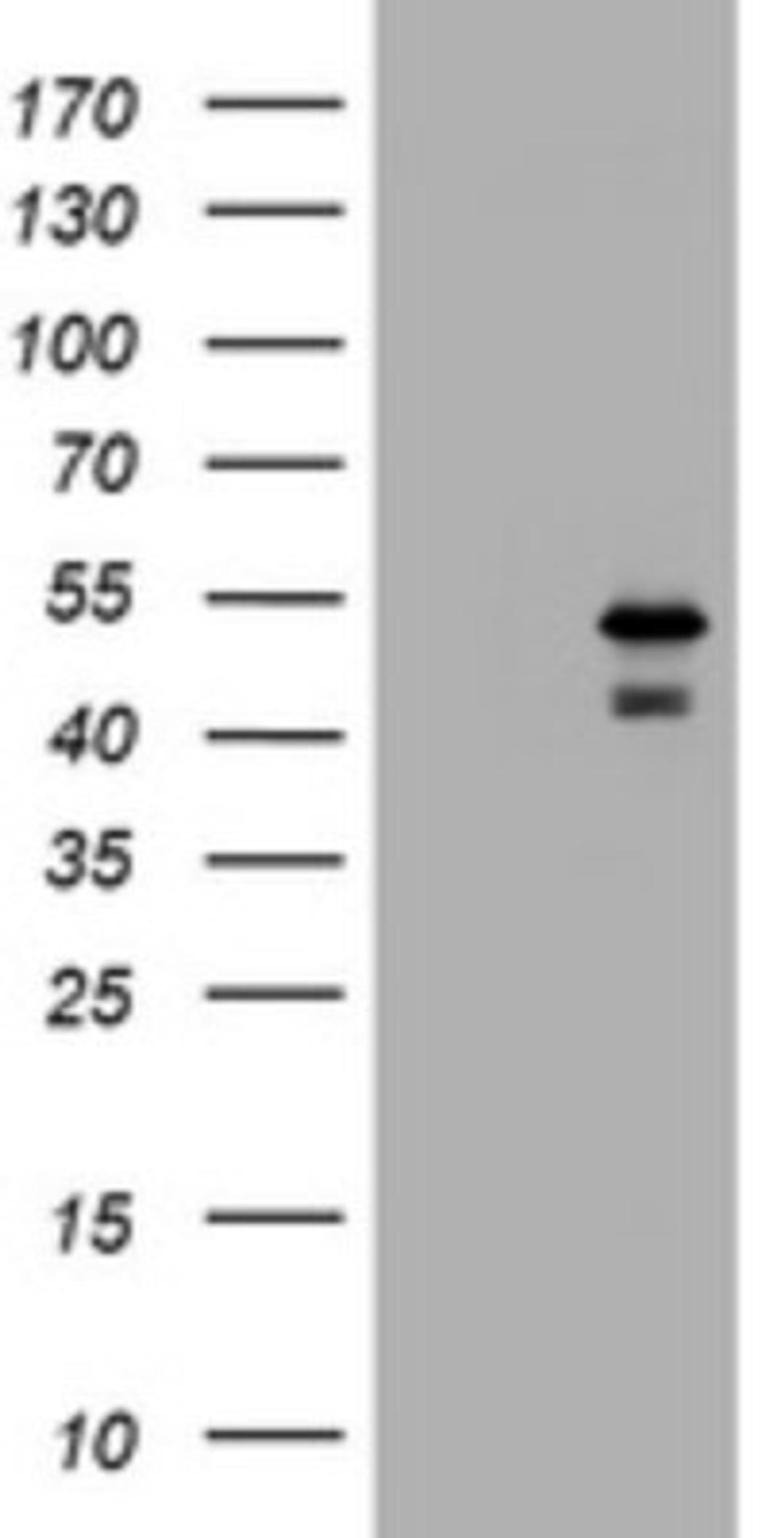 Western Blot: PARVB Antibody (1B7) [NBP2-46327] - Analysis of HEK293T cells were transfected with the pCMV6-ENTRY control (Left lane) or pCMV6-ENTRY PARVB.