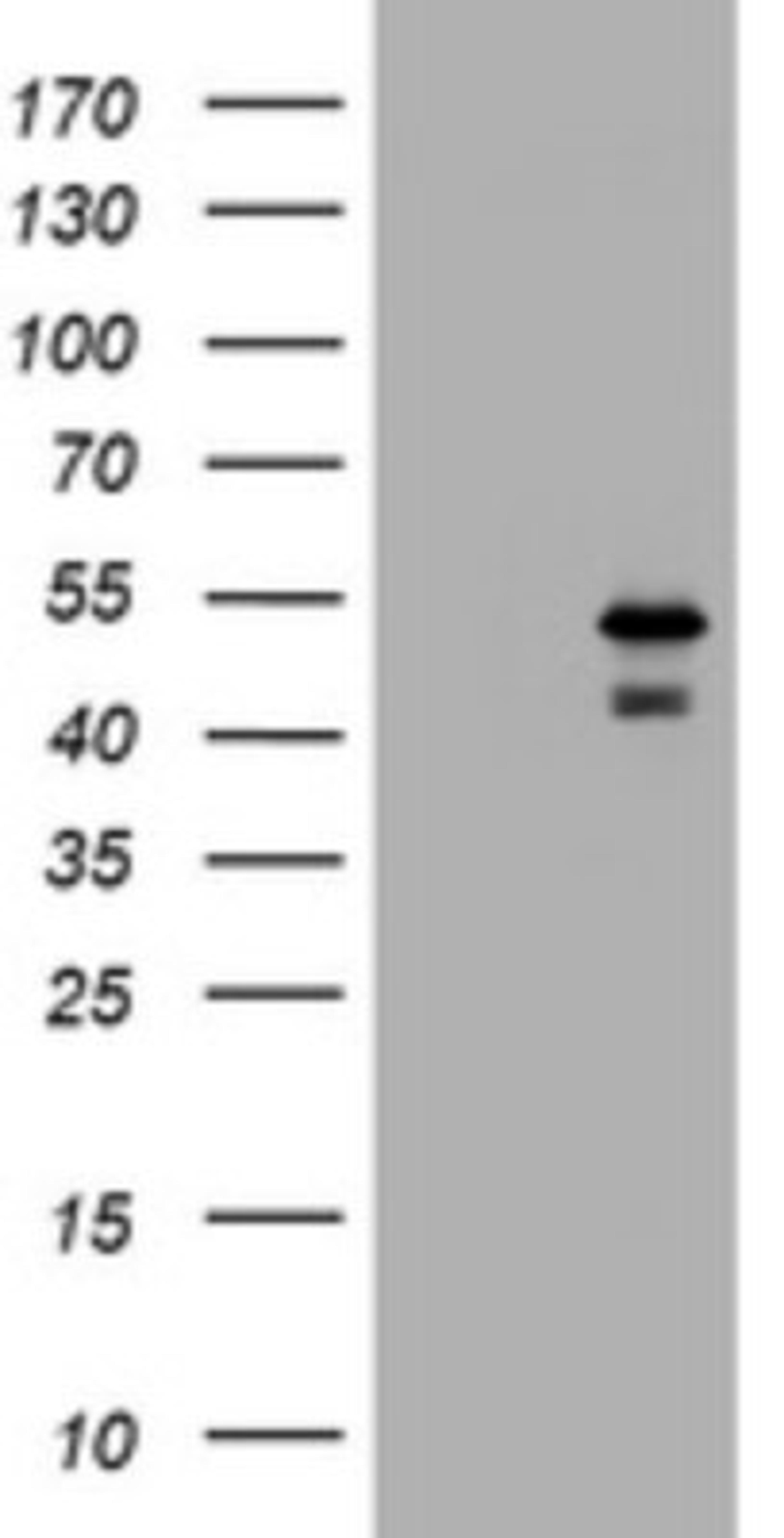 Western Blot: PARVB Antibody (1B7) [NBP2-46327] - Analysis of HEK293T cells were transfected with the pCMV6-ENTRY control (Left lane) or pCMV6-ENTRY PARVB.