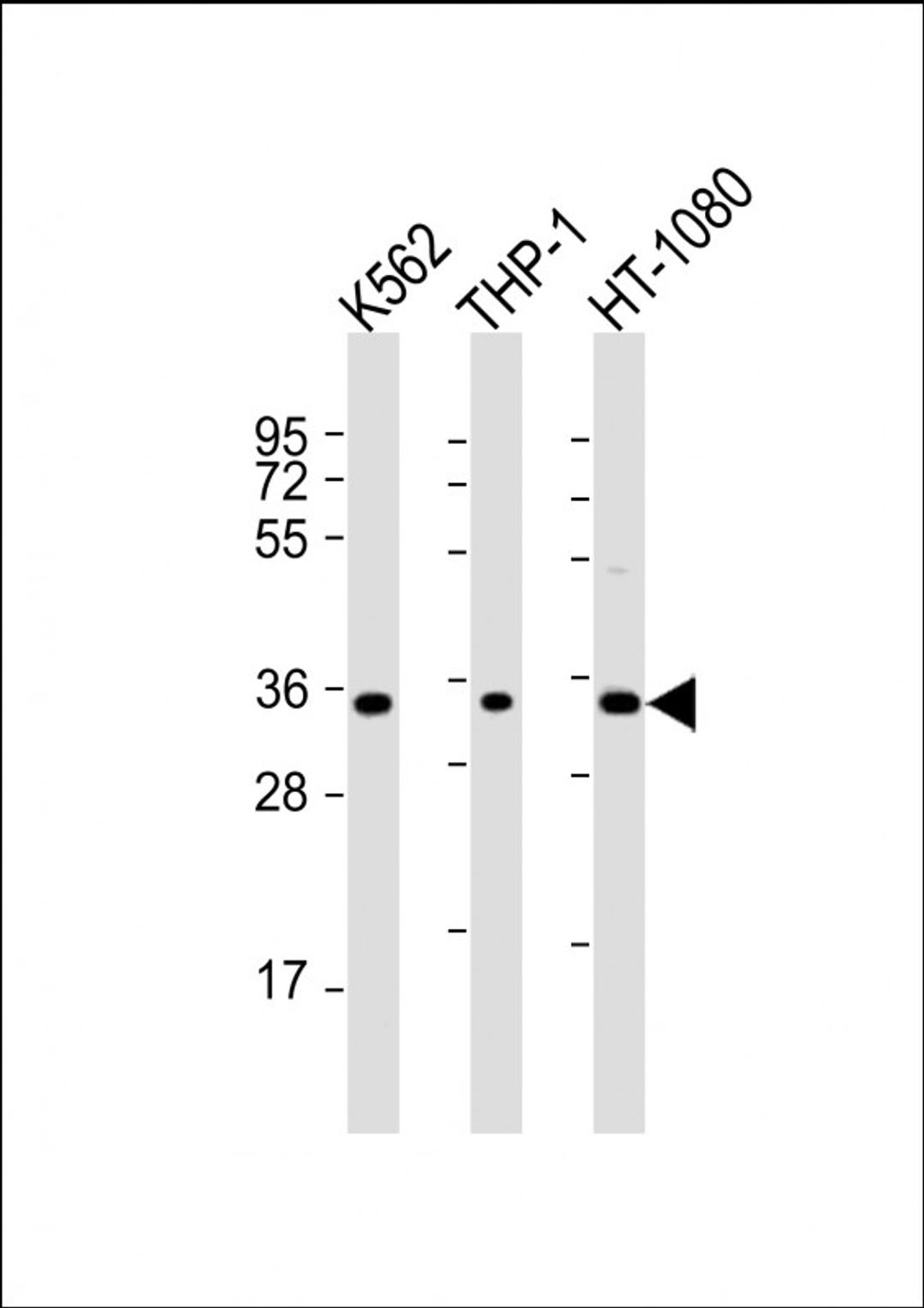 Western Blot at 1:2000 dilution Lane 1: K562 whole cell lysate Lane 2: THP-1 whole cell lysate Lane 3: HT-1080 whole cell lysate Lysates/proteins at 20 ug per lane.