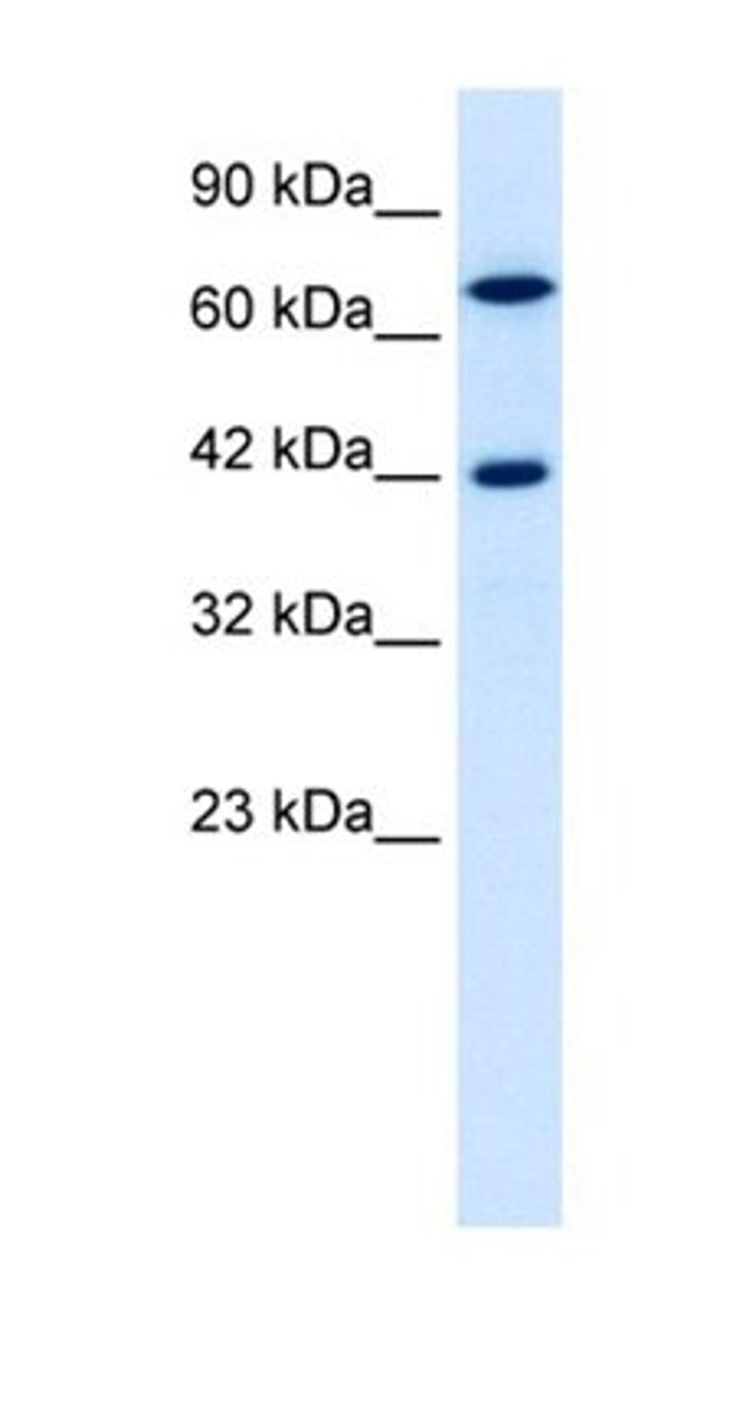 Western blot analysis of Jurkat cell lysate tissue using TOX2 antibody