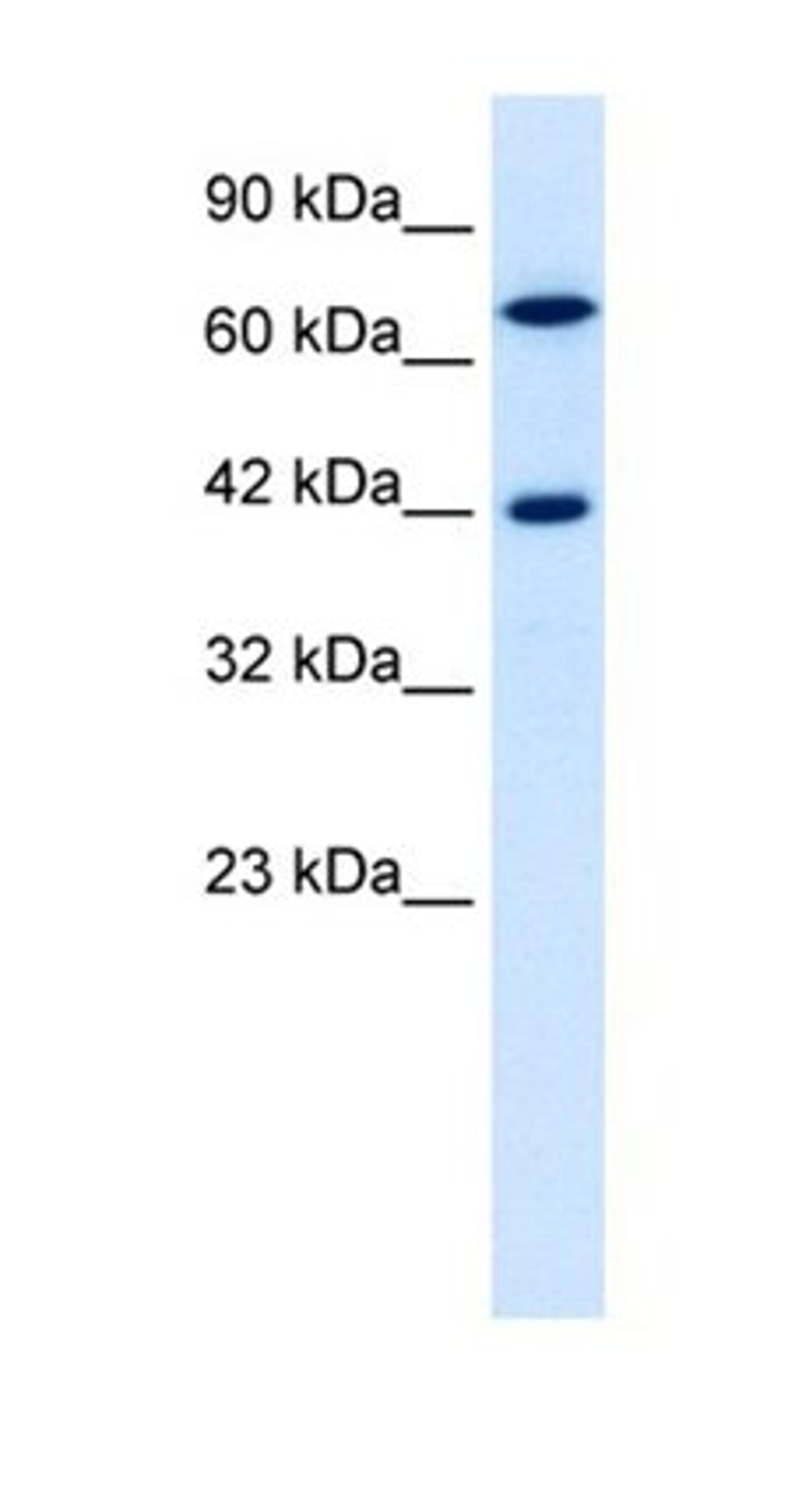 Western blot analysis of Jurkat cell lysate tissue using TOX2 antibody