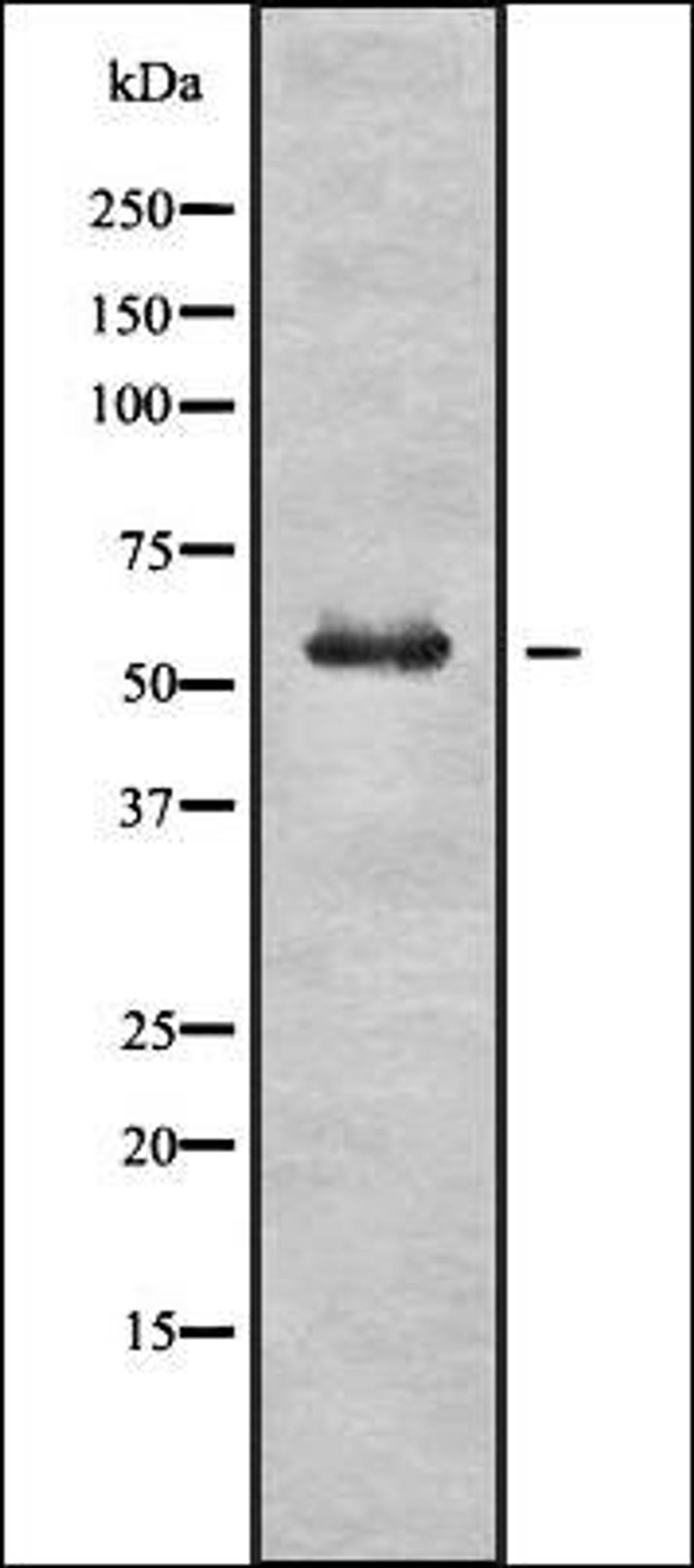 Western blot analysis of HuvEc whole cell lysates using GBA antibody