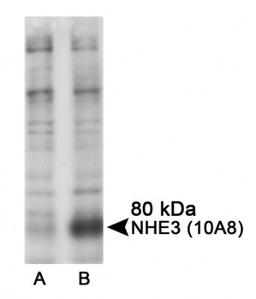 Western Blot: NHE3 [p Ser605] Antibody (10A8) [NB110-74678] - Detection of phospho Ser605 in transfected COS-7 cells using NB110-74678. A. untreated B. forskolin and IBMX treated