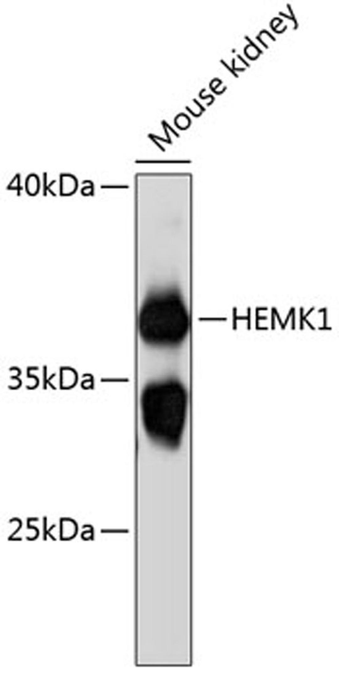 Western blot - HEMK1 antibody (A12651)