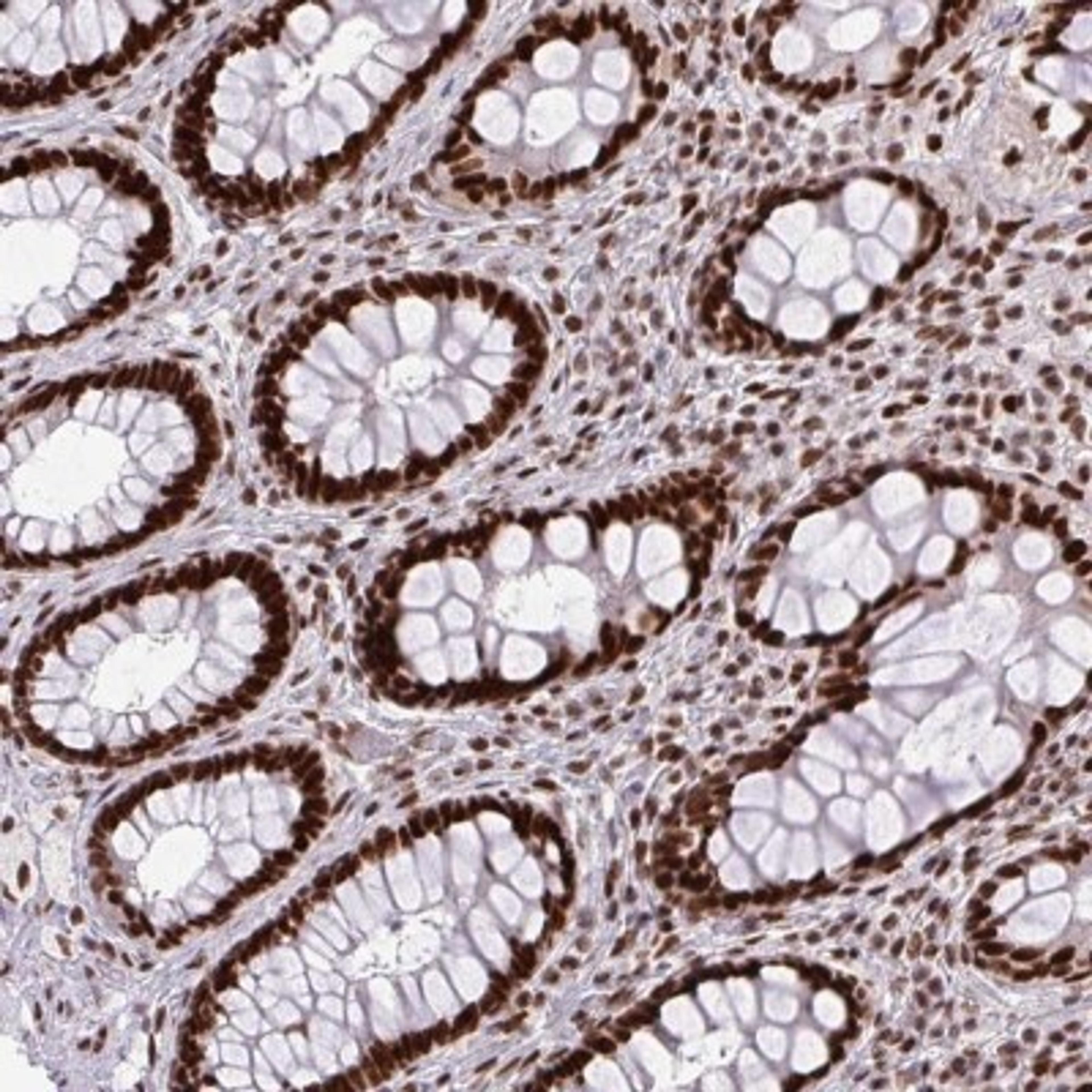 Immunohistochemistry: CDYL Antibody [NBP2-34011] - Immunohistochemical staining of human rectum shows strong nuclear positivity in glandular cells.