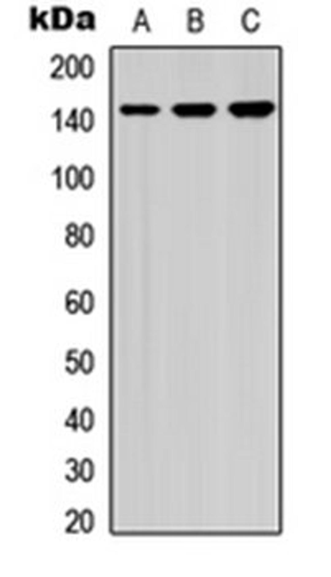 Western blot analysis of A549 (Lane 1), NS-1 (Lane 2), PC12 (Lane 3) whole cell lysates using HCAP (phospho-S1083) antibody