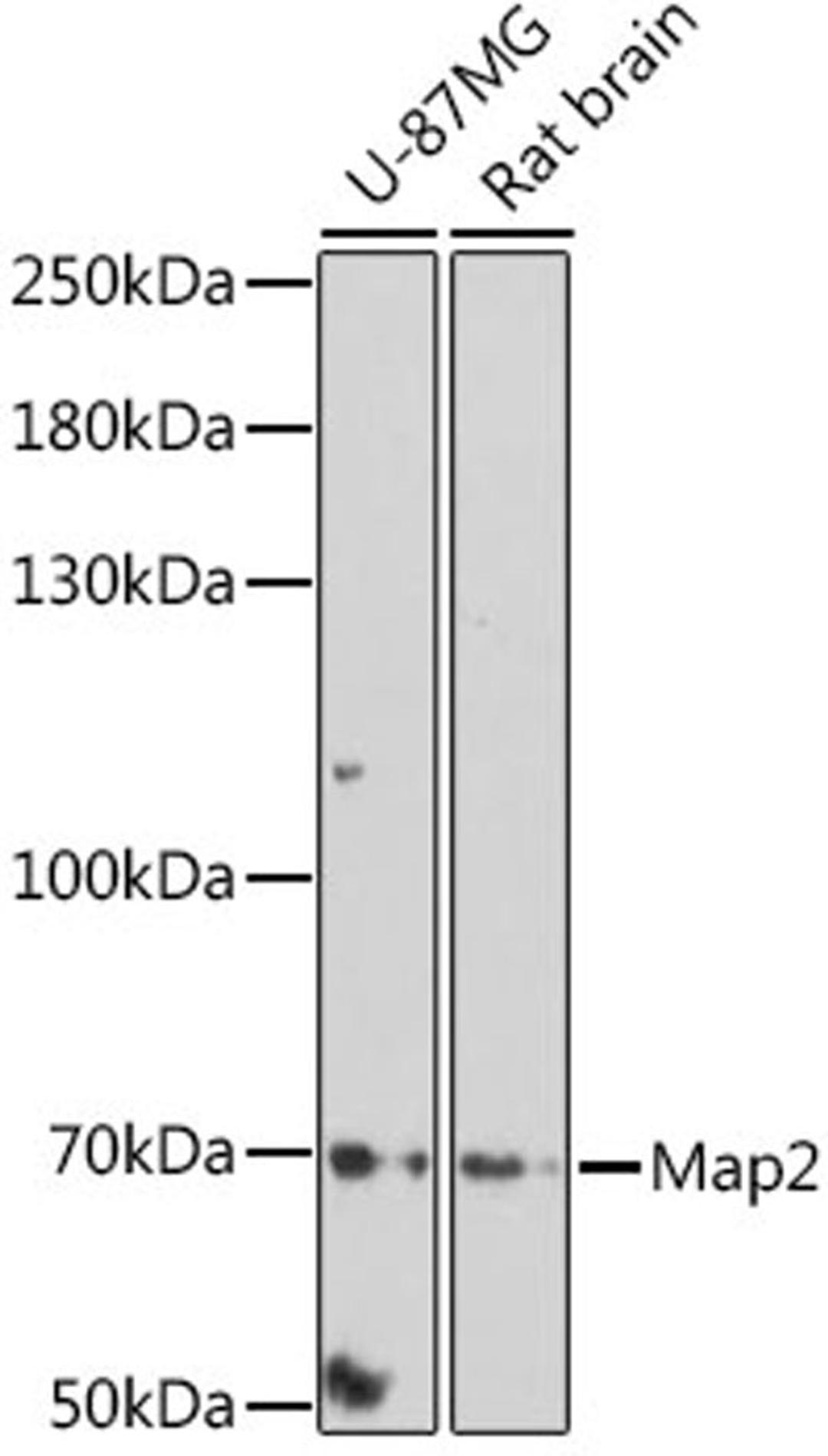 Western blot - Map2 antibody (A0453)