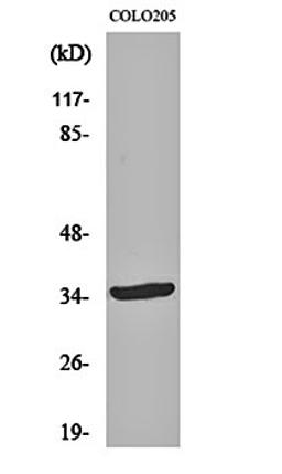 Western blot analysis of COLO205 cell lysates using OTUD2 antibody