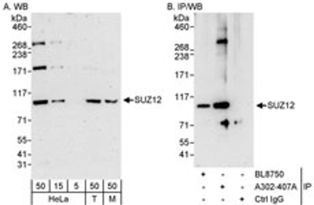 Detection of human and mouse SUZ12 by western blot (h & m) and immunoprecipitation (h).