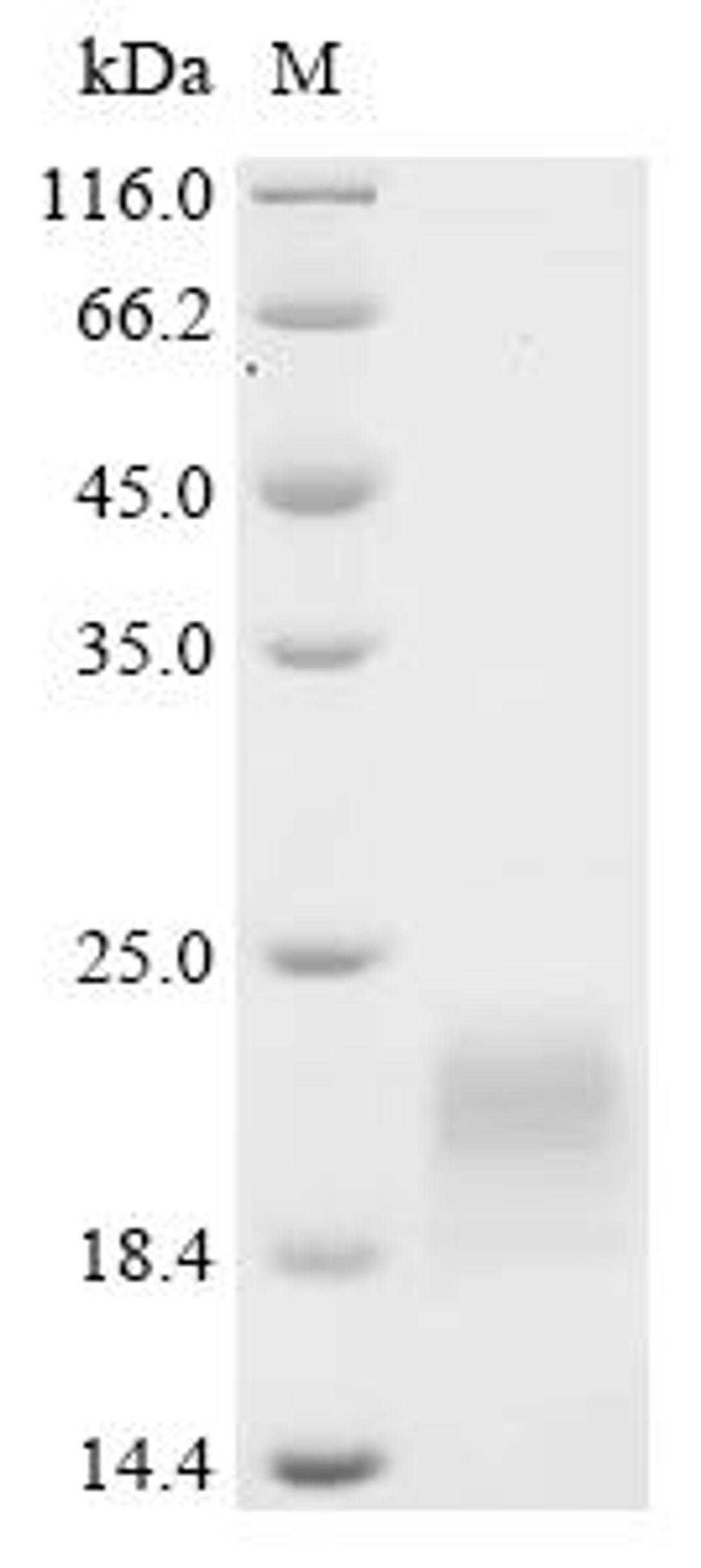 (Tris-Glycine gel) Discontinuous SDS-PAGE (reduced) with 5% enrichment gel and 15% separation gel.