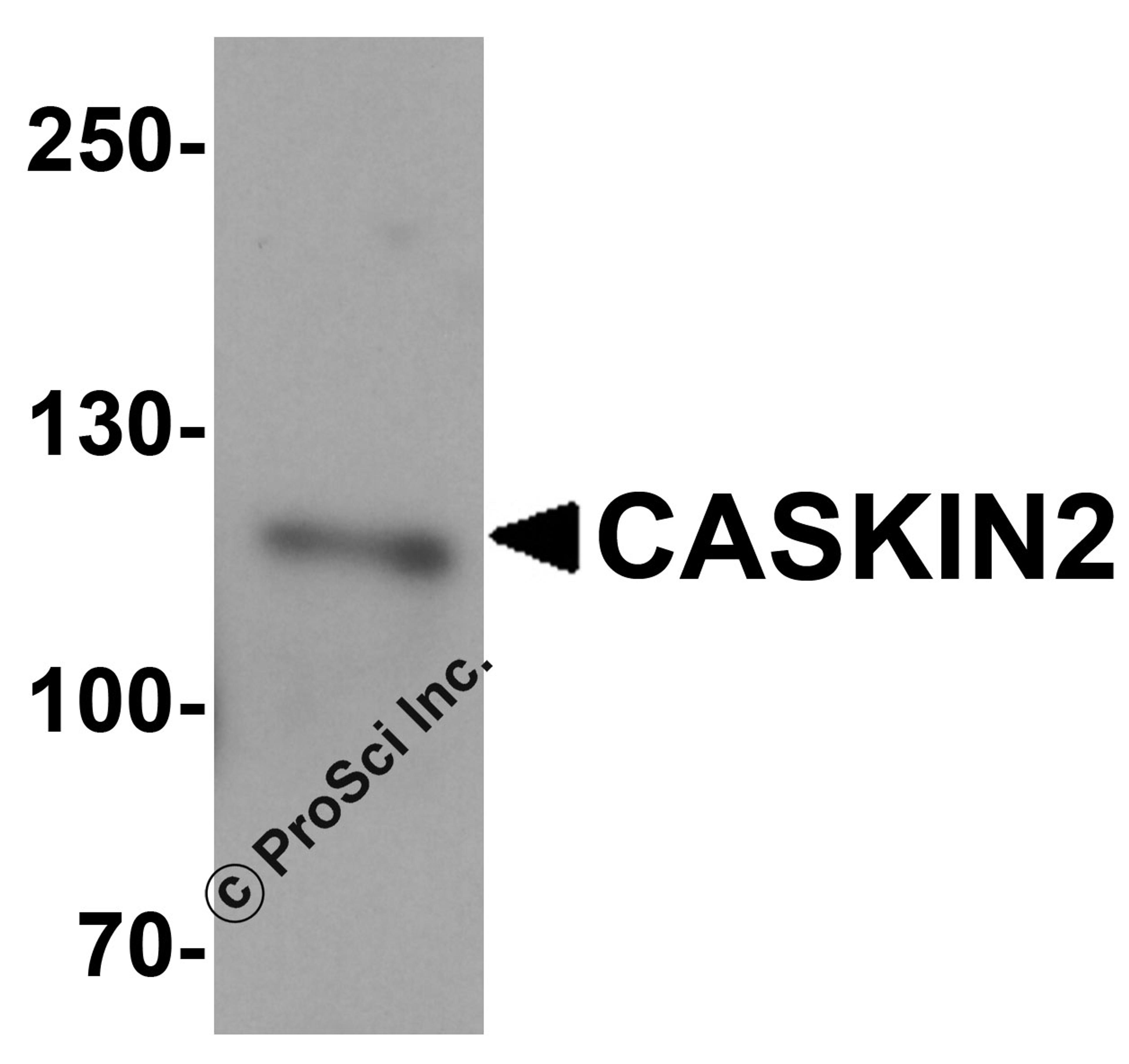 Western blot analysis of CASKIN2 HeLa cell tissue lysate with CASKIN2 antibody at 1 μg/mL.