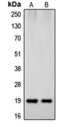 Western blot analysis of HeLa (Lane 1), human brain (Lane 2) whole cell lysates using SNCB antibody