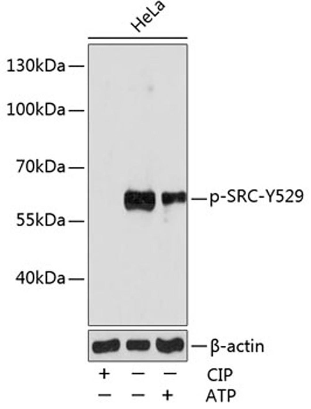 Western blot - Phospho-SRC-Y529 pAb (AP0185)