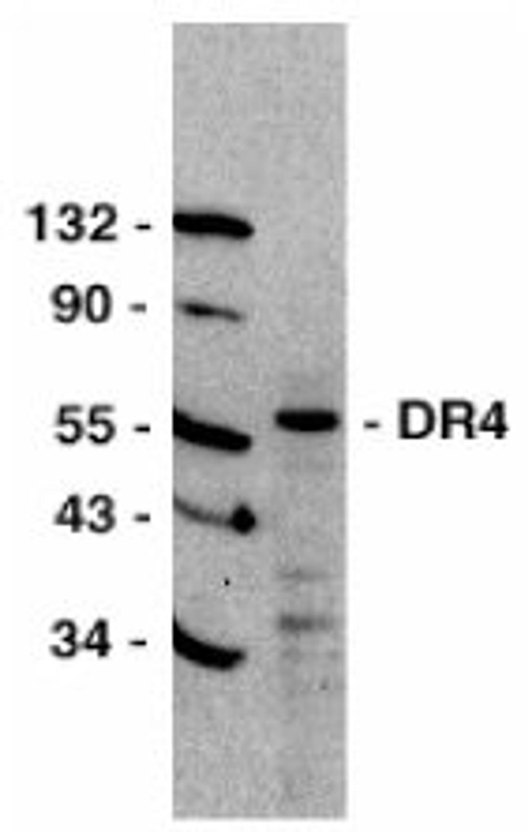 Western blot analysis of HeLa whole cell lysate probed with Rabbit anti Human CD261 (AHP439)