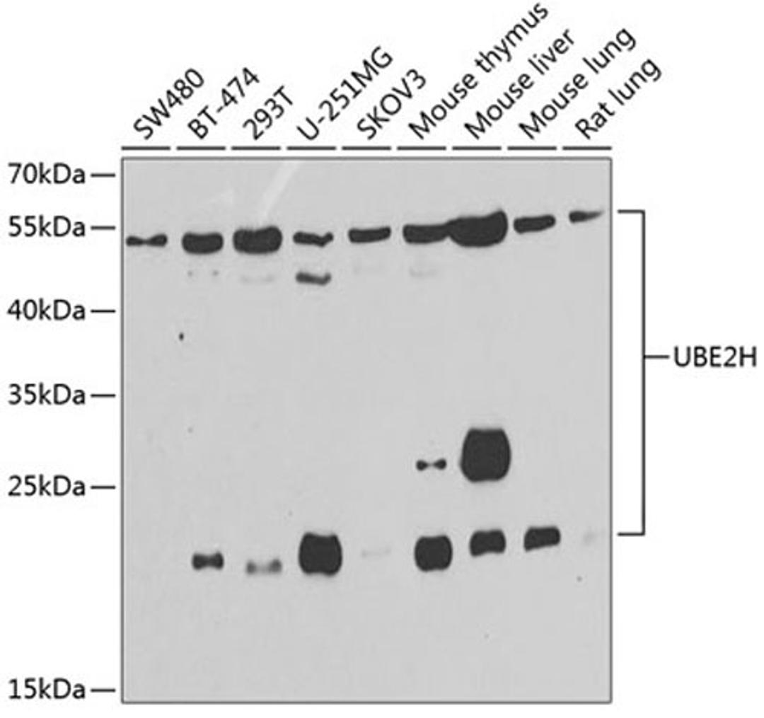 Western blot - UBE2H antibody (A7344)