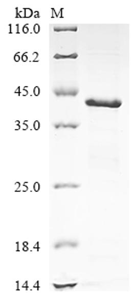 (Tris-Glycine gel) Discontinuous SDS-PAGE (reduced) with 5% enrichment gel and 15% separation gel.