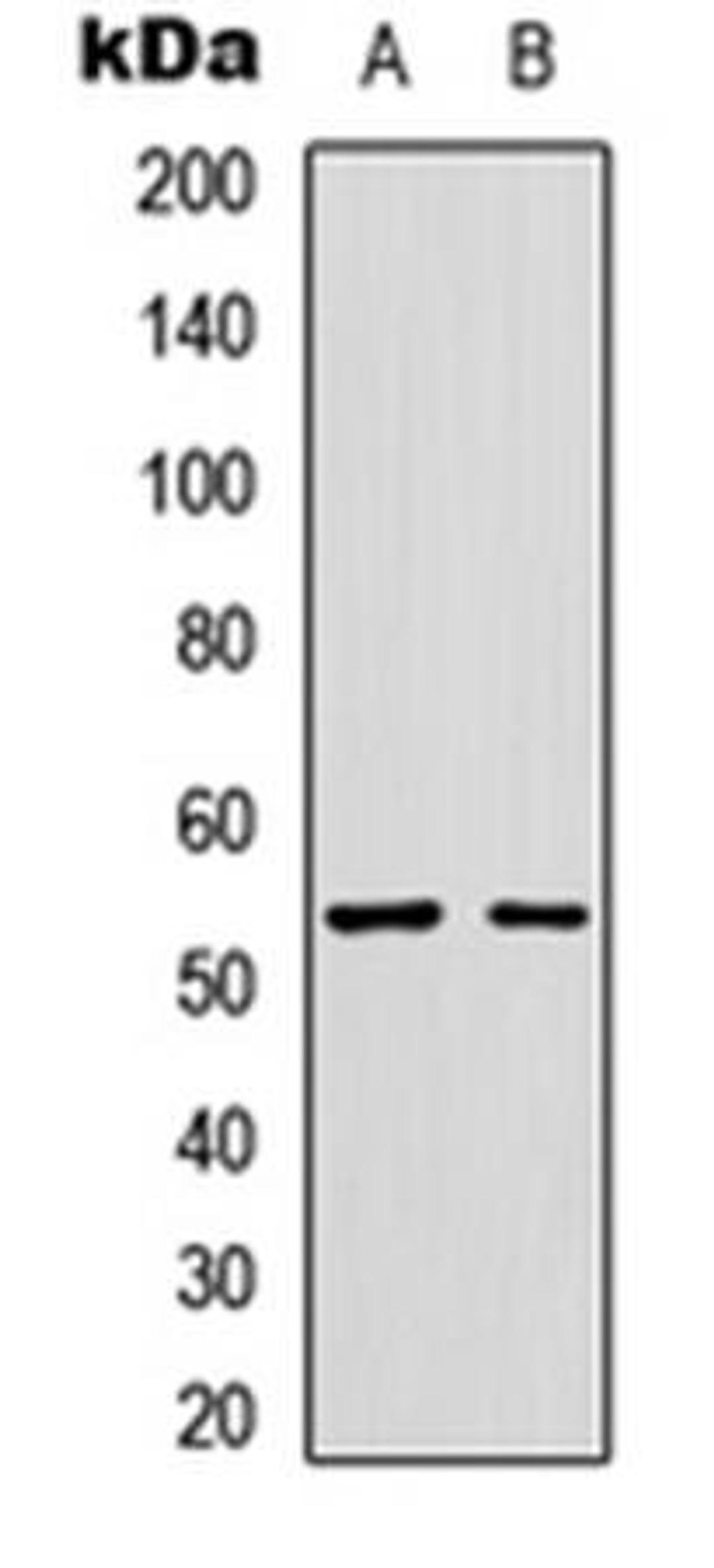 Western blot analysis of SKNSH (Lane1), HuvEc (Lane2) whole cell using GLP-1 R antibody