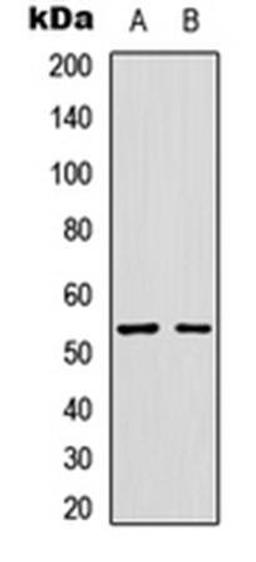 Western blot analysis of SKNSH (Lane1), HuvEc (Lane2) whole cell using GLP-1 R antibody