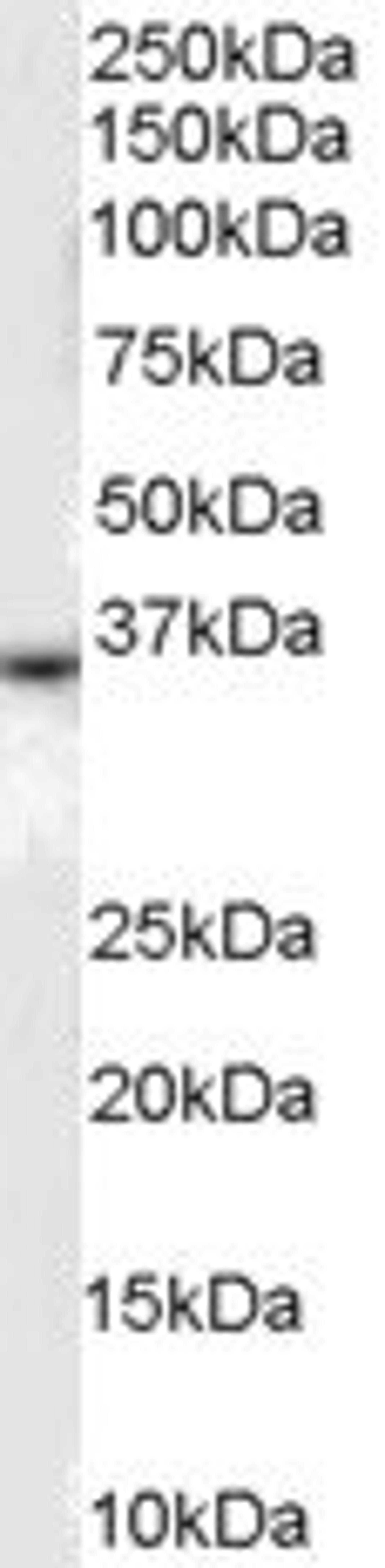 Western blot analysis of human liver lysate using DARC antibody