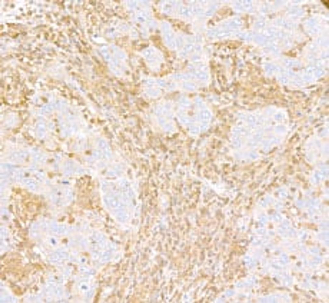 Detection of human ARHGDIB/D4-GDI by immunohistochemistry.