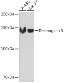 Western blot - Desmoglein 3 Rabbit mAb (A5227)