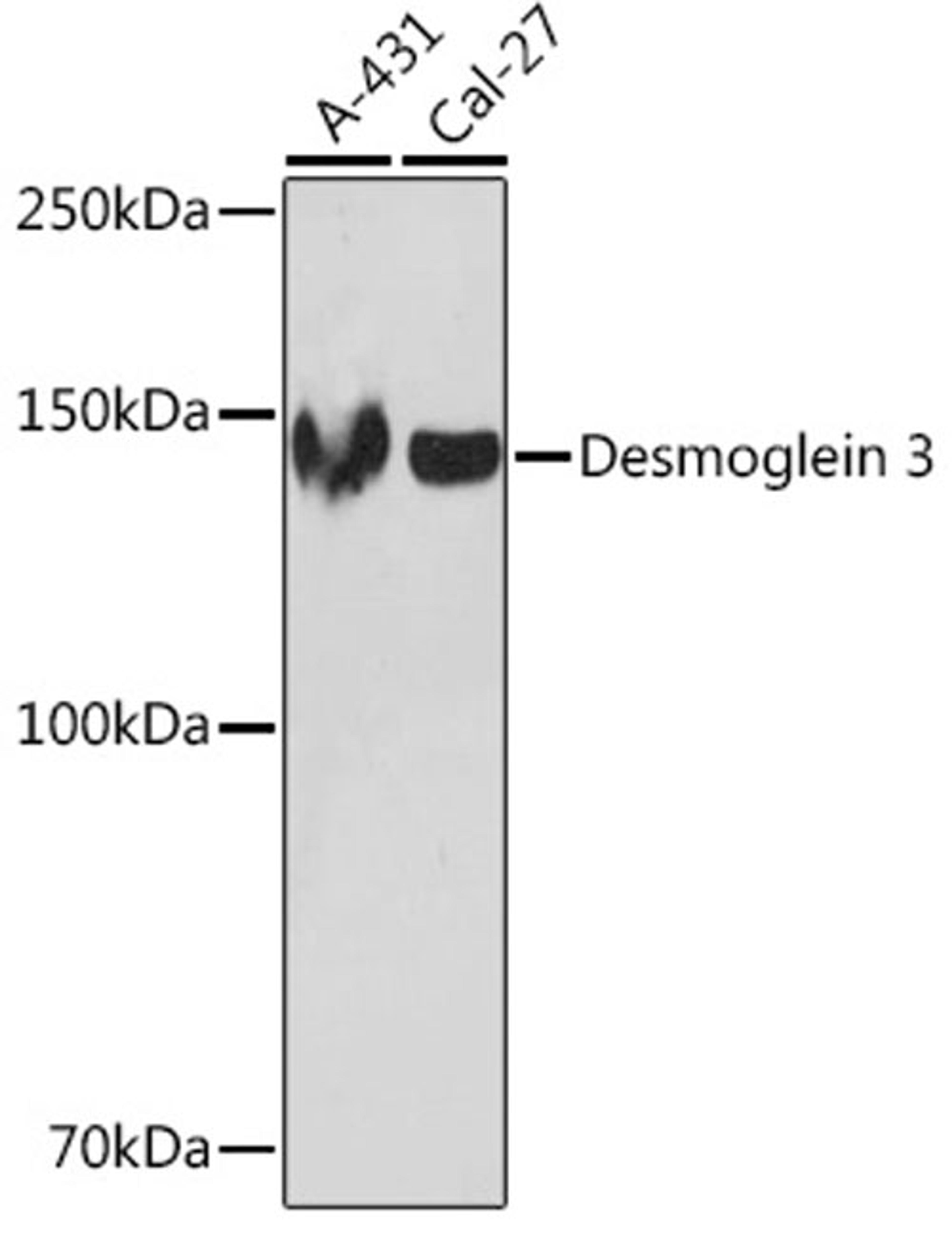 Western blot - Desmoglein 3 Rabbit mAb (A5227)