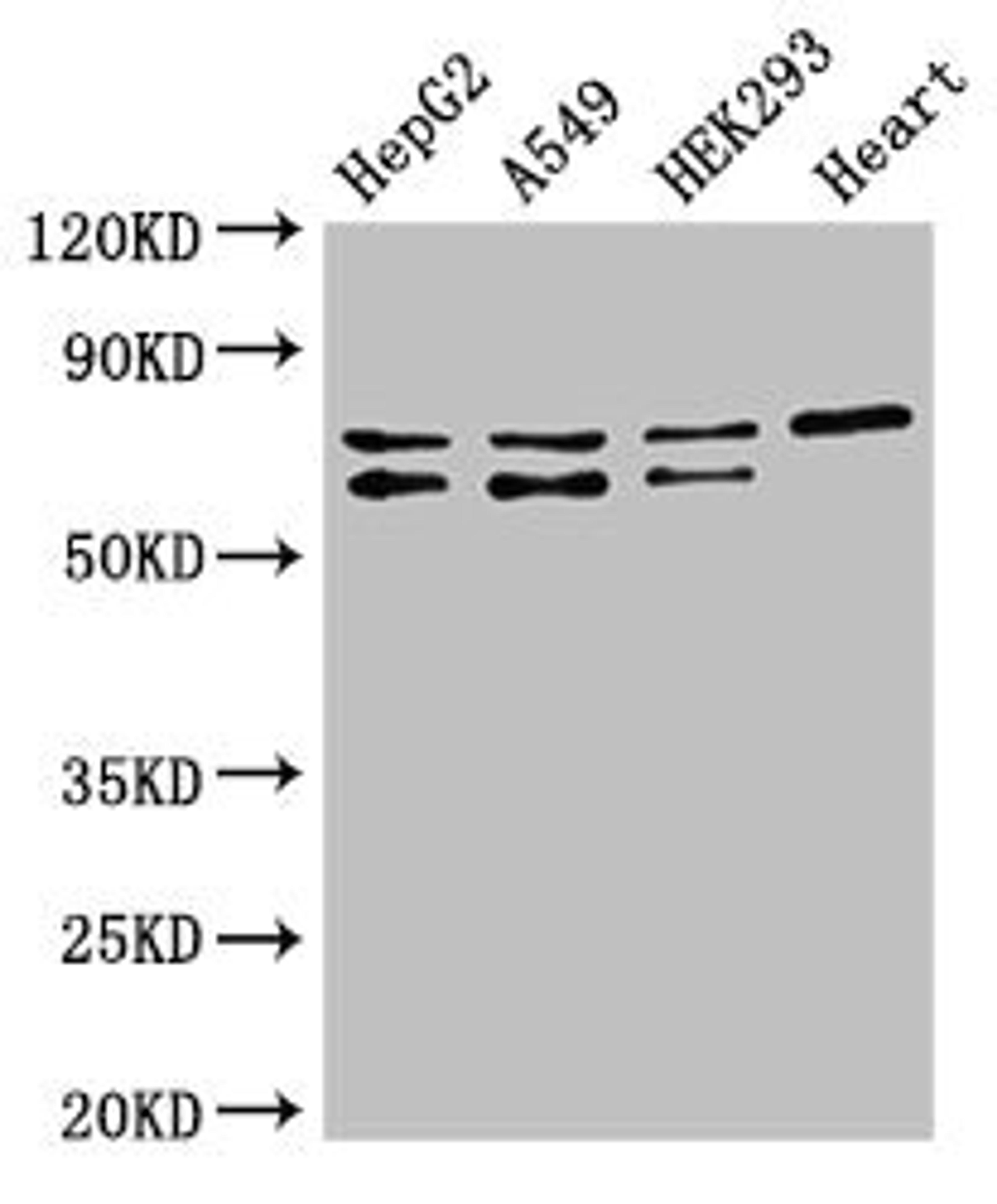 Western Blot. Positive WB detected in: HepG2 whole cell lysate, A549 whole cell lysate, HEK293 whole cell lysate, Mouse heart tissue. All lanes: HIF3A antibody at 2.5µg/ml. Secondary. Goat polyclonal to rabbit IgG at 1/50000 dilution. Predicted band size: 73, 69, 40, 67, 63, 65 kDa. Observed band size: 73, 69 kDa