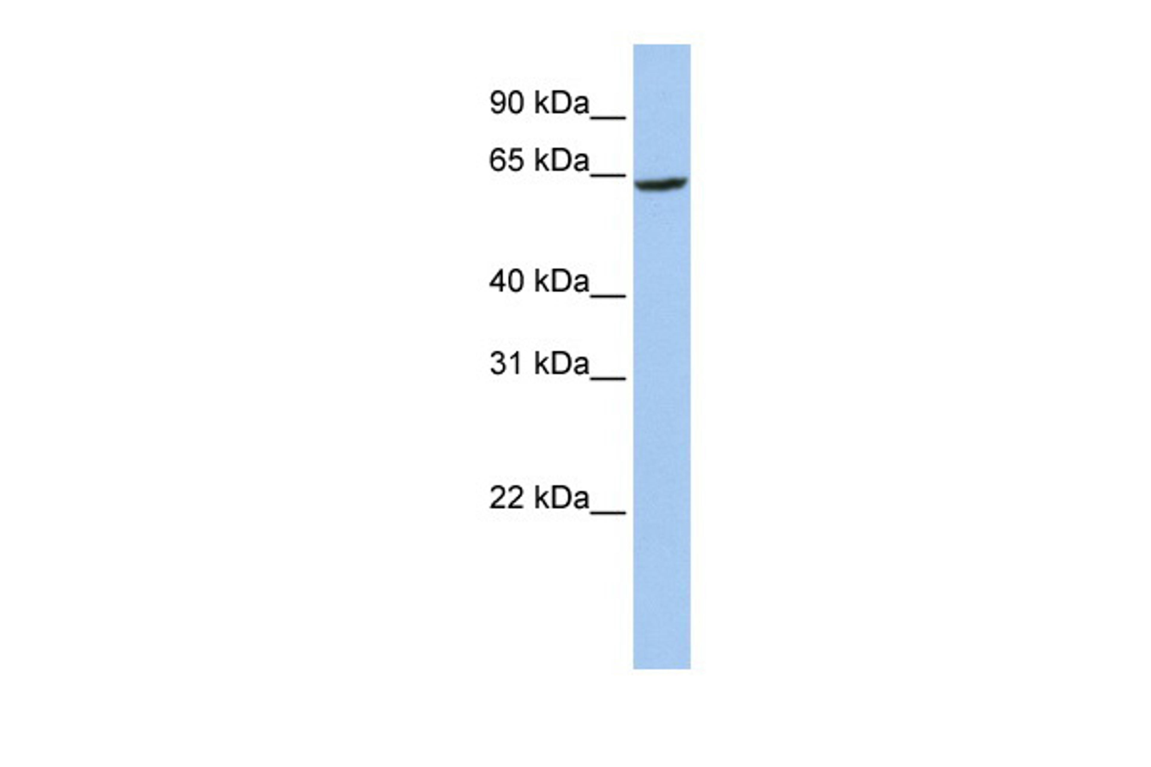 Antibody used in WB on Human 721_B at 0.2-1 ug/ml.