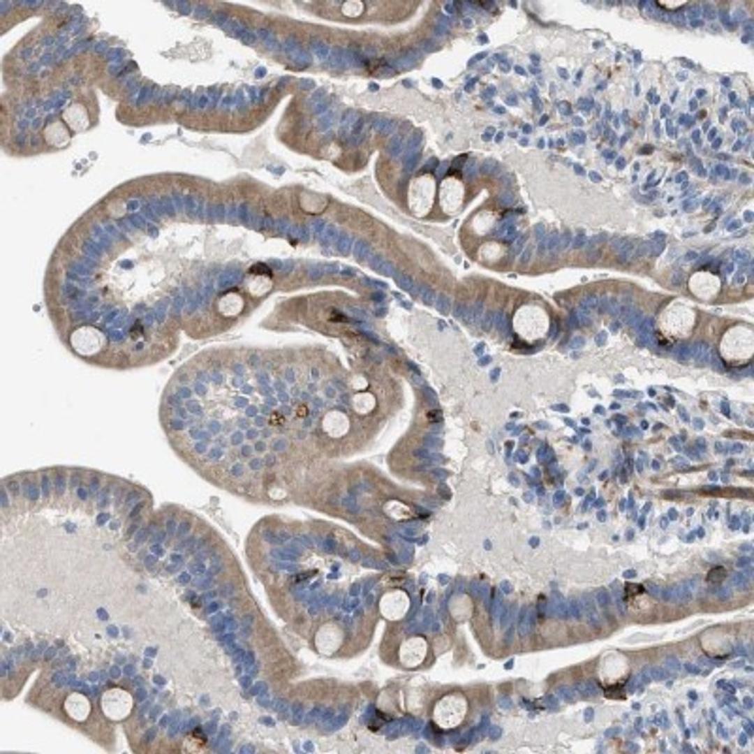 Immunohistochemistry: Acyloxyacyl Hydrolase Antibody [NBP2-33892] - Immunohistochemical staining of human duodenum shows strong positivity in Goblet cells.